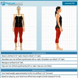 Posture analysis report showing front and side views of a person with alignment measurements and deviations listed.
