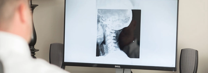 Monitor showing an X-ray image of the cervical spine.